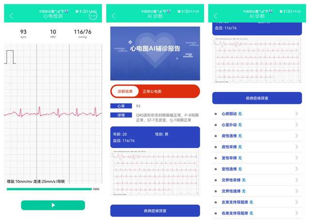 亚健康提前预知，腕上轻商务健康助手，didoE10血压智能手表体验